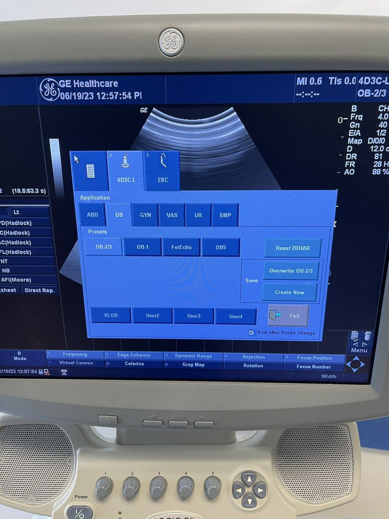 Ge Scanarchive File 2007 GE LOGIQ P5 Ultrasound System with 4D3C-L , E8C Transducer & Prin ...