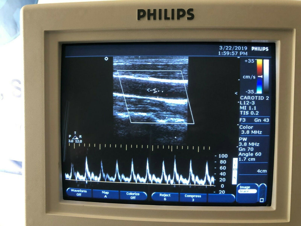 Copy of Phillips Envisor C Ultrasound Color System with 2 Transducers. - MEDPROSHOP 